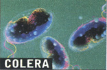 Vibrione del colera